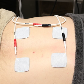 Electrical Muscle Stimulation - Plains Edge Chiropractic